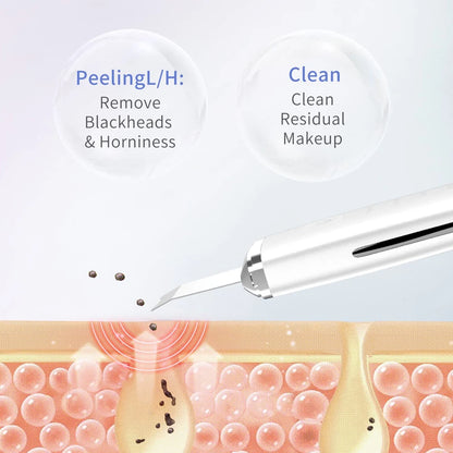 Ultrasonic Skin Scraper Peeling Blackhead Remover