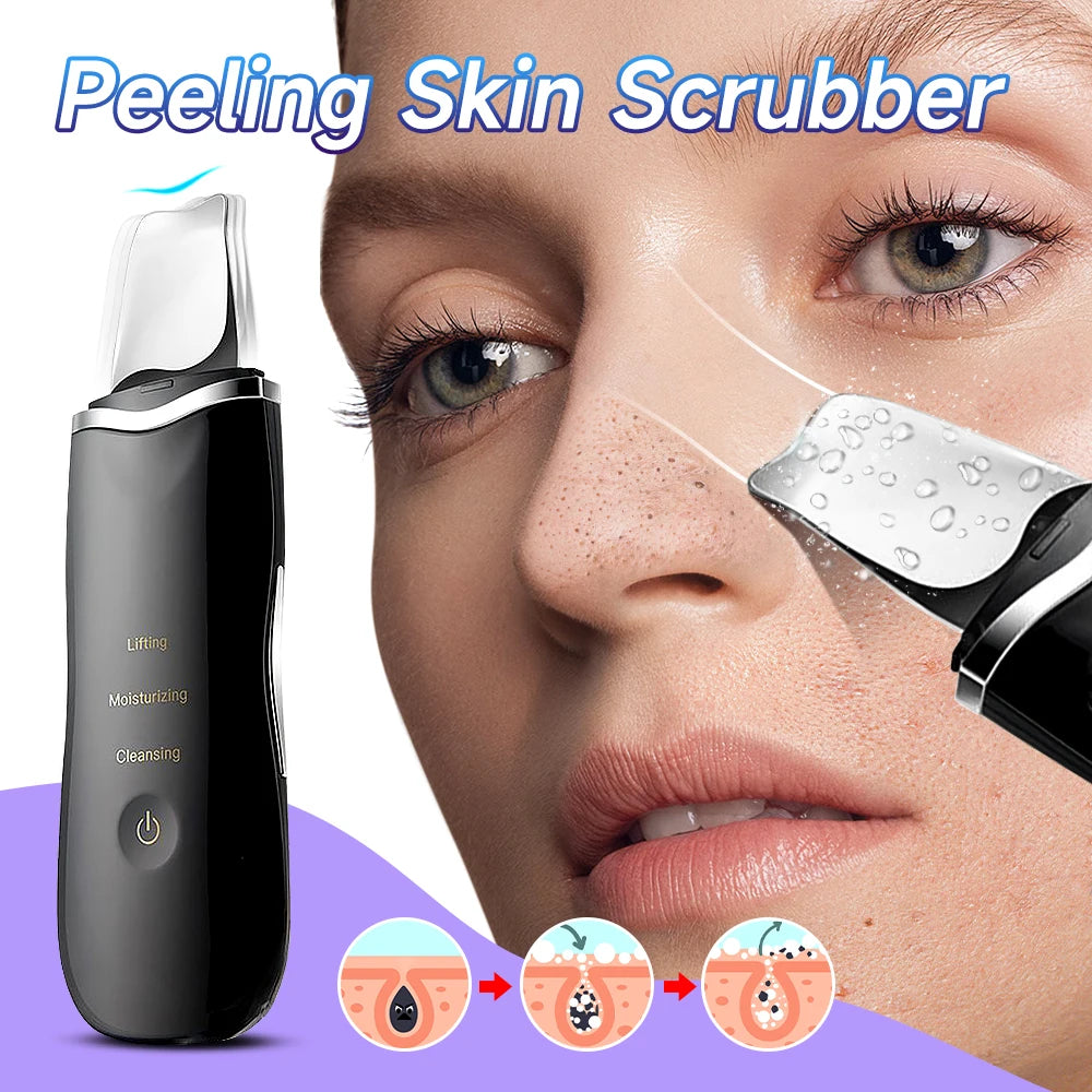 Ultrasonic Skin Scraper Peeling Blackhead Remover